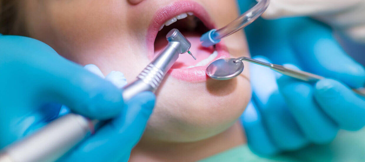 Dental Treatment Image