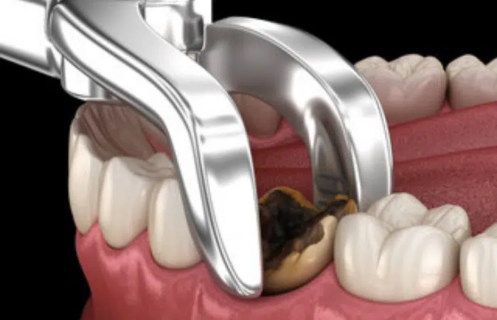 Dental Treatment Image